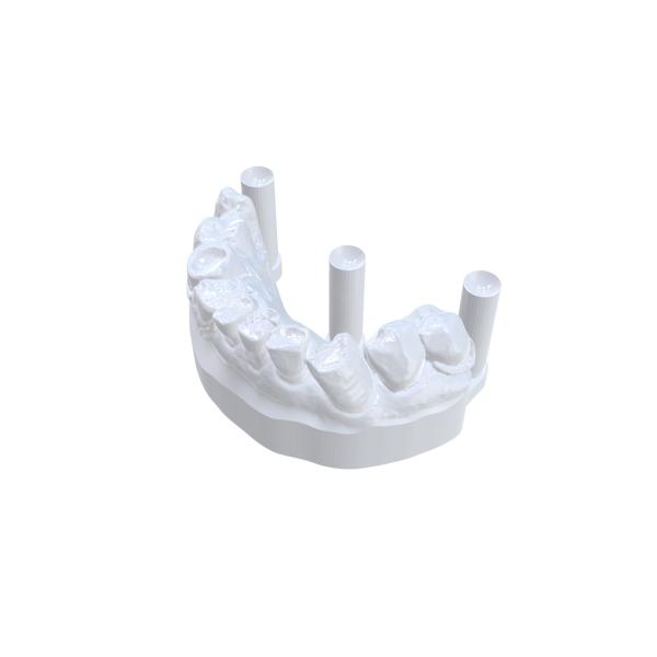 Discover the Power of Dental 3D Printing Materials for Your Dental Practice
