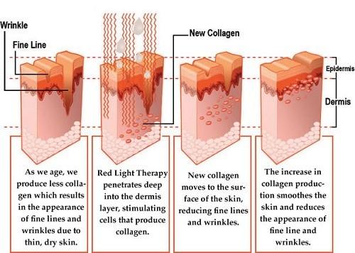 Face Body PDT Light Therapy Device ,  660nm Red Light Therapy Equipment