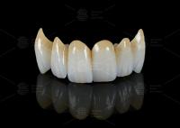Alta translucidez de contorno completo Zirconia Puente Resistencia a las astillas Estética natural