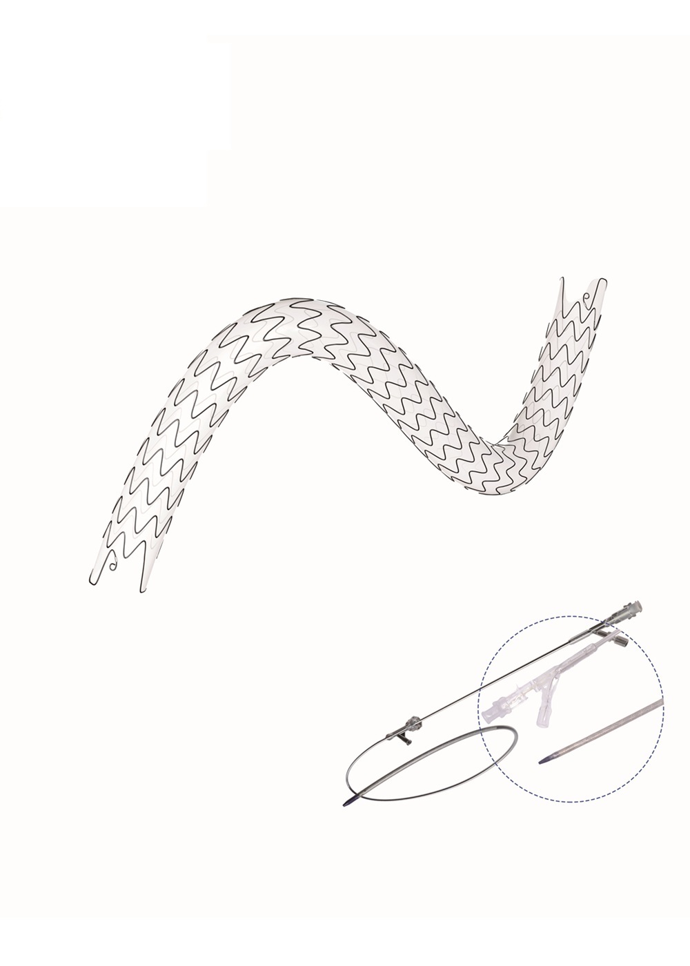 High-Precision Nitinol Ureteral Stent System with Low-Friction Coating and Large Lumen