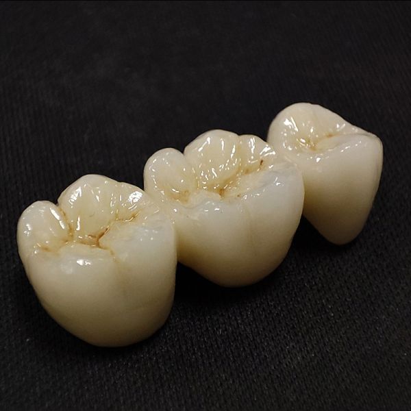 Customized Specification Denture Products Zirconia Ceramic Crowns and Bridge with Fast Turnaround Time CE FDA Certified