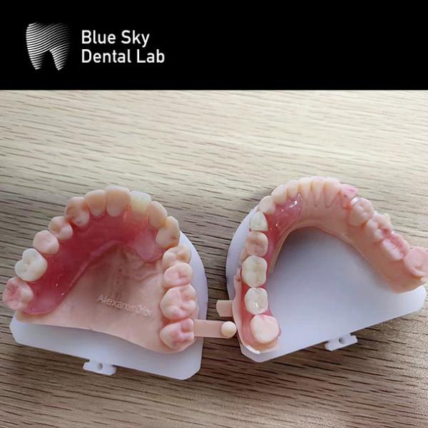 Plastic Implant Procedure Cases The Ultimate Solution for Organizing and Transporting Dental Implants