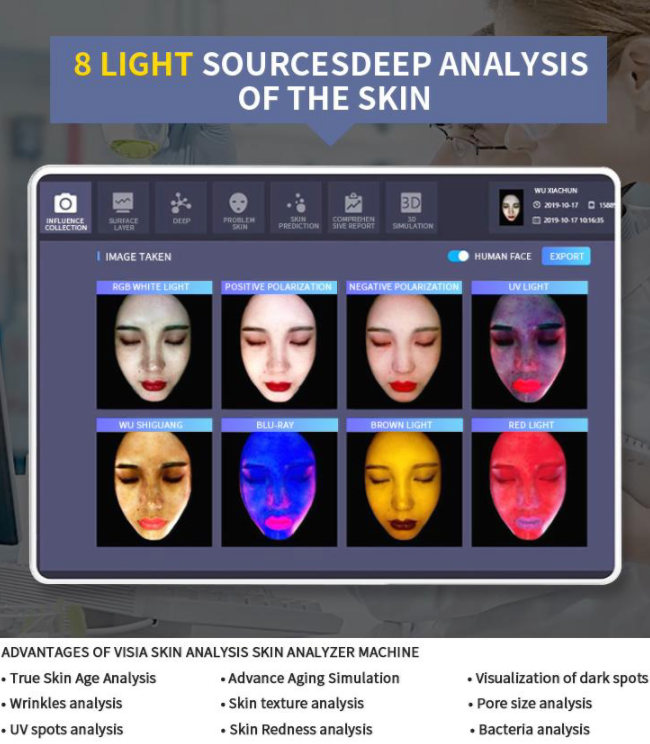 3D AI Face Skin Analyzer Diagnosis Facial Tester Scanner 36 Megapixels