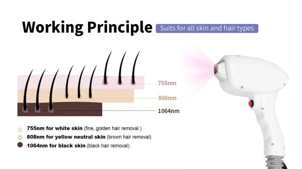 Hair Removal Machine Permanent Hair Remover Diode Laser 755 808 1064 Nm Diode Laser Hair Remover