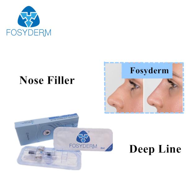 Linha profunda enchimentos cutâneos à base de ácido hialurónicos de Fosyderm 2ml