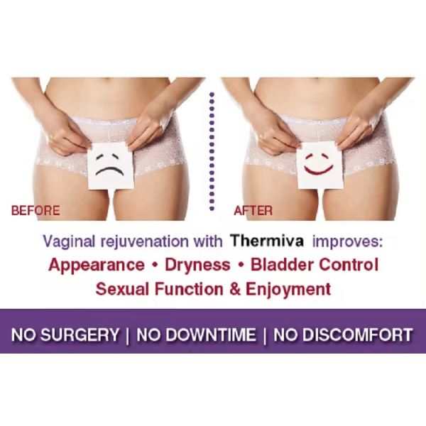 Non-Invasive Female Private Tightening Instrument Skin Tightening Machine