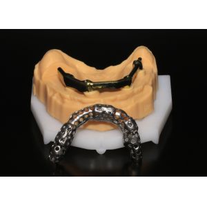 Gigital Dental Laboratory | Class 5 All On 4 AOX Implants With Hybrid Titanium