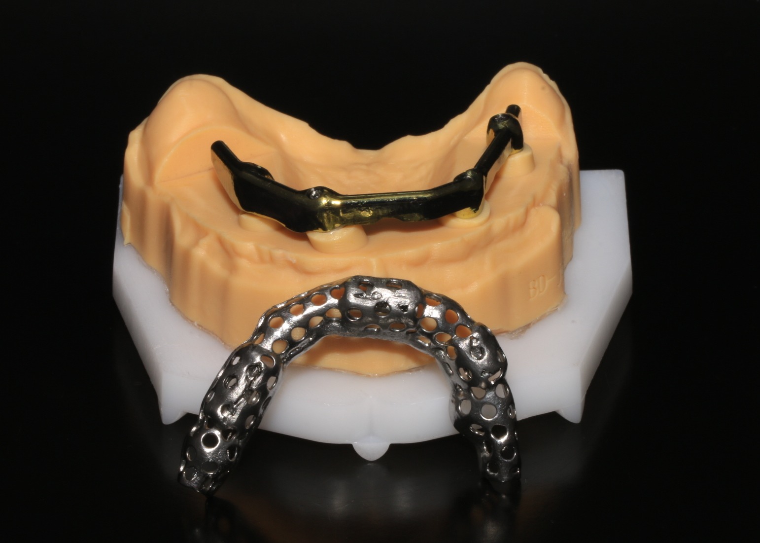 Class 5 All On 4 AOX Implants With Hybrid Titanium Bar / Clips / Metal Mesh / Full Denture