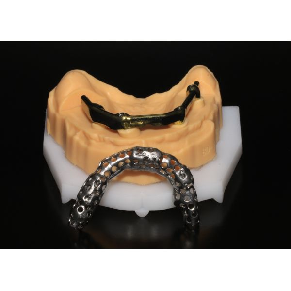 Gigital Dental Laboratory | Class 5 All On 4 AOX Implants With Hybrid Titanium Bar / Clips / Metal Mesh / Full Denture