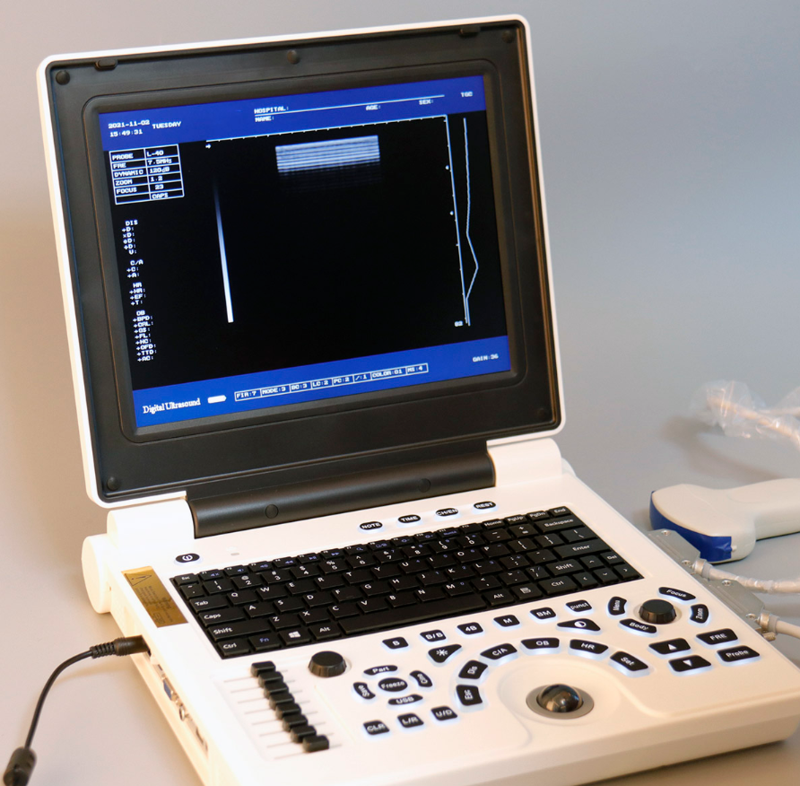 Black&white Portable Medical Ultrasound Scanner Machine for Vet Use