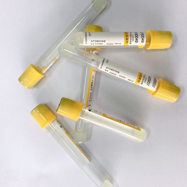 Пластмасса/стеклянные лампы желтеют верхнюю кровь трубки собирая противокоагулятор