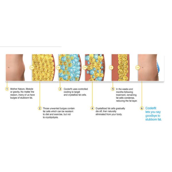 Safety Coolsculpting Slimming Beauty Machine For Fat Reduction / Body Contouring