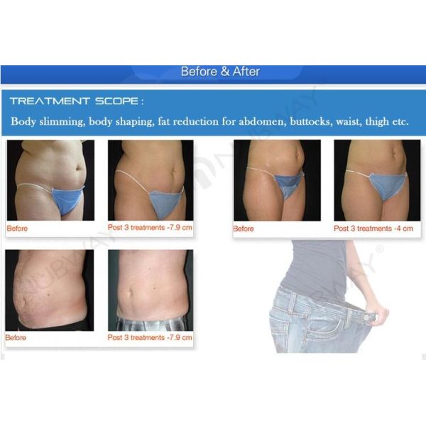 New beauty equipment 13mm focus depth hifu cellulite reduction body weight measuring machine with 10 inch touch screen