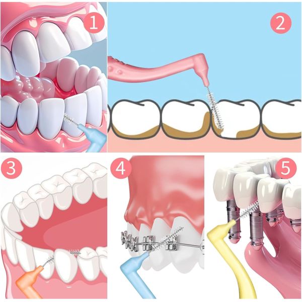 50pcs Interdental Brushes 5 Sizes Set Soft Dental Brushes With Braces Oral Cleaning