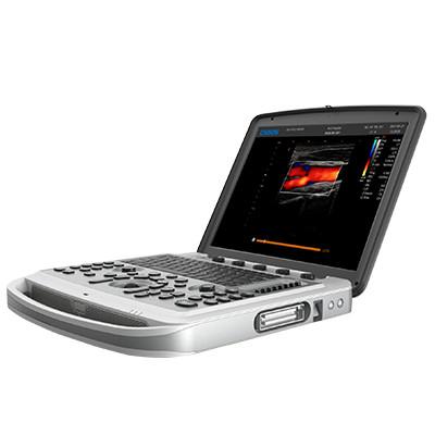 120° Rotatable Chison SonoBook 6 Portable Laptop Ultrasound Machine