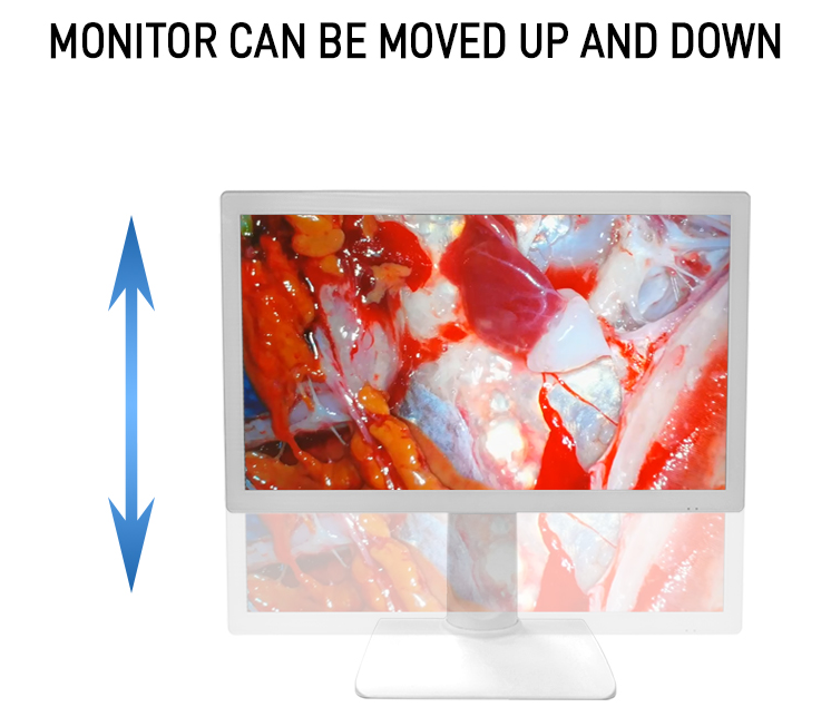 Equipo médico 4K FHD 27 pulgadas de cámara de endoscopio pantalla de monitor para endoscopio