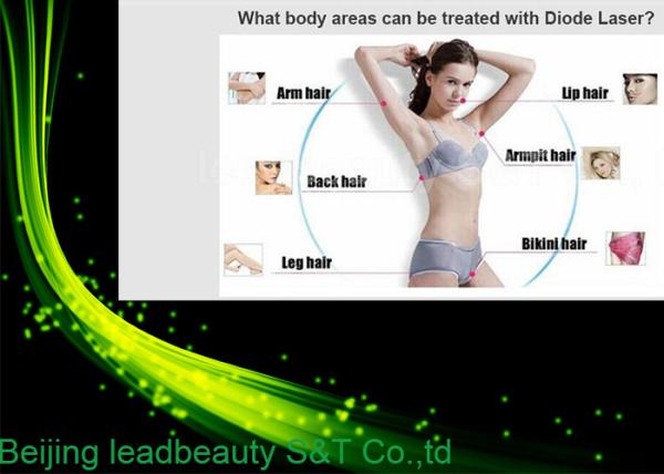 2016 600W high output power newest beauty machine 808nm diode laser hair removal