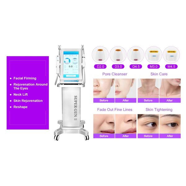 Body Shipping Hifu 7d Machine Portable White CE