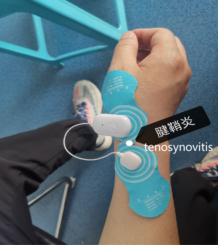 Низкочастотный mic-электрический настоящий столб терапией