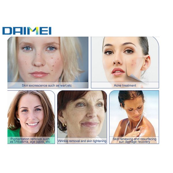 Fractional Carbon Dioxide Laser Resurfacing Machine , Acne Scar Removal Device