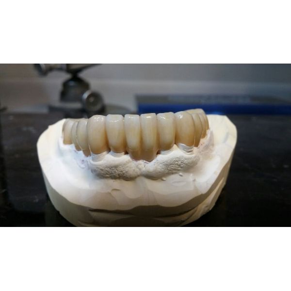 ST-white Dental Zirconia Ceramic 98*16mm Open System Using T0 Magic Liquid