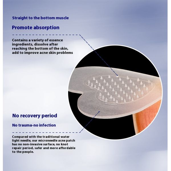 Single Sided Painless Microneedle Acne Patch Microcrystals Water Activated PE Adhesive Sticker for Masking Use