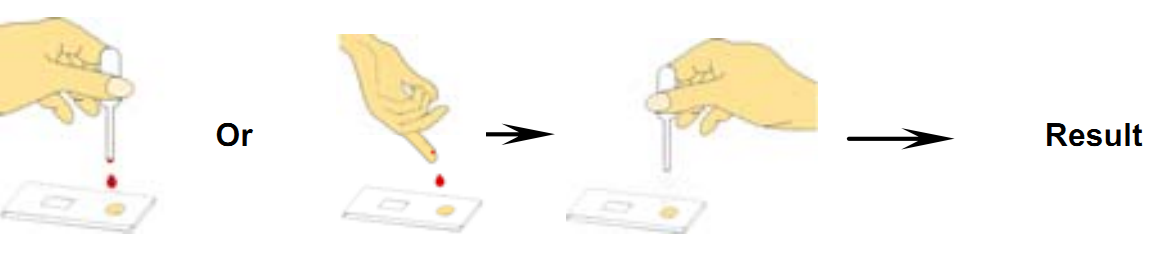 Tuberculosis Infectious Disease Blood Tests 4mm Cassette Serum Specimens CE