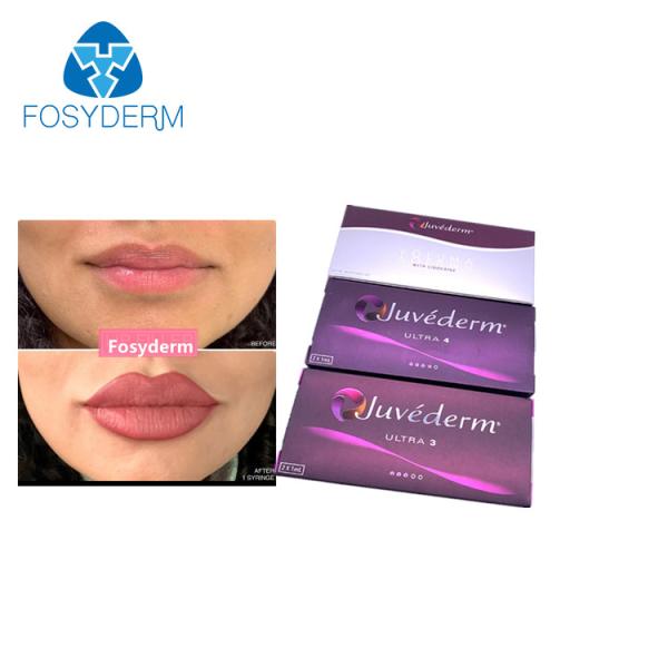 Enchimento cutâneo ácido hialurónico 2x1.0ml do realce do bordo de Juvederm Ultra3