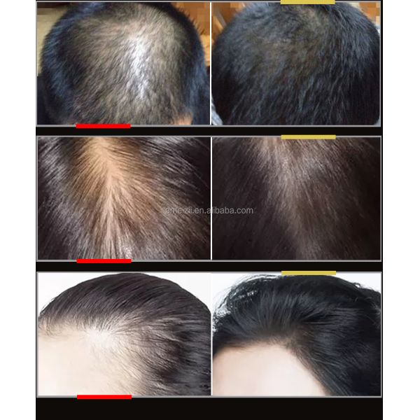 Natural Argan Hair Regrowth Serum Anti Loss With Ginger Essential Oil