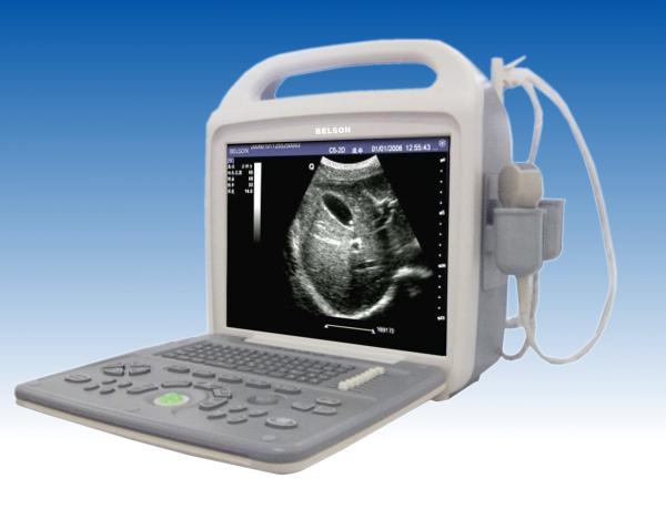 12  LCD Screen Portable Ultrasound Device Digital High Resolution With B, B+B, 4B, B/M M Modes