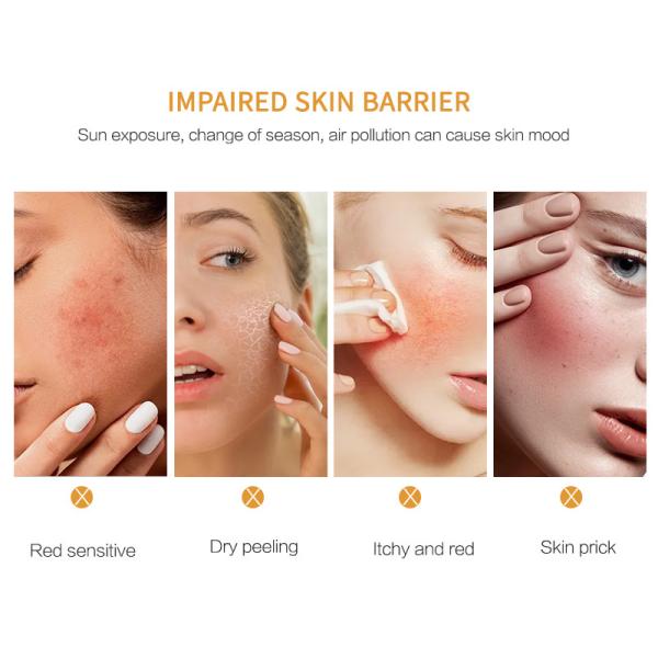 MSDS Facial Skin Care Products Soro de pétalas de camomila orgânico Soro facial natural para pele sensível