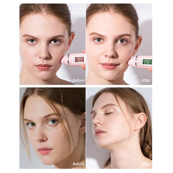 Лепесток завода сияя лицевые продукты заботы кожи OEM маски развел водой