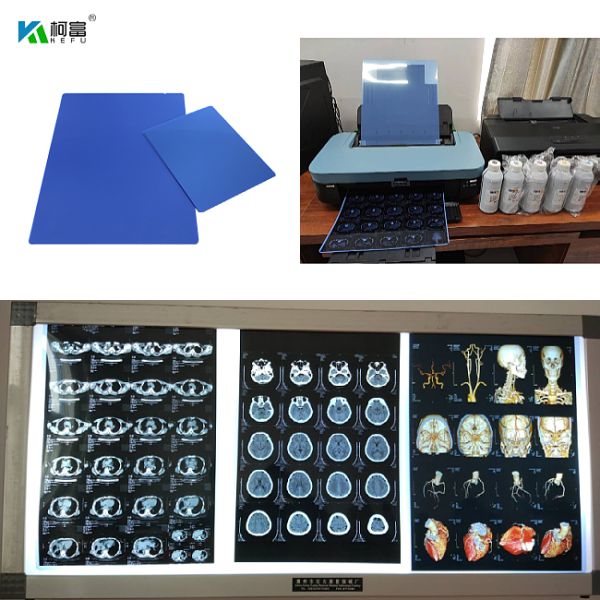 210microns Inkjet Medical X Ray Film For CT DR MRI  And 3D CT MRI Image Output 14x17