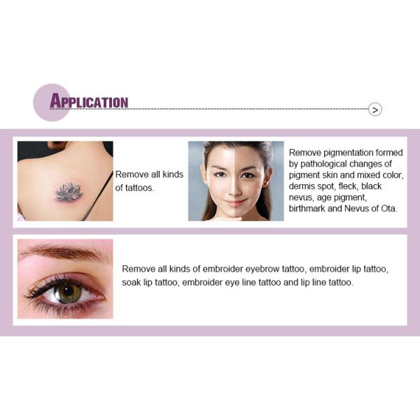 1000mj ND YAG Laser Hair Removal Machine Body Tattoo Pigments Removal Without Injury