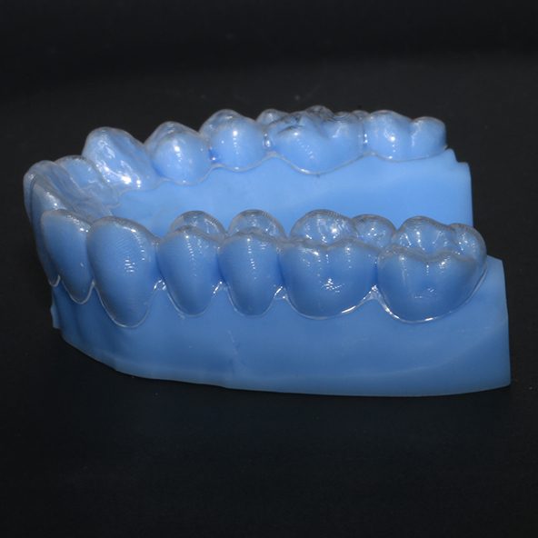 Digital Dental Solutions Lab | Custom Invisible Clear Aligner Removable With Shorter Treatment Time
