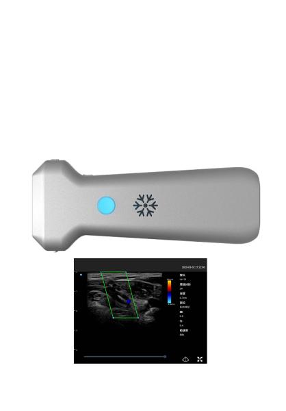 8.3MHz Wireless Ultrasound Probe Depth 12.6cm Linear Probe Ultrasound