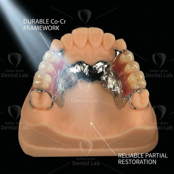 Acrylic Printed Partial Framework Design China Dental Lab Comfort