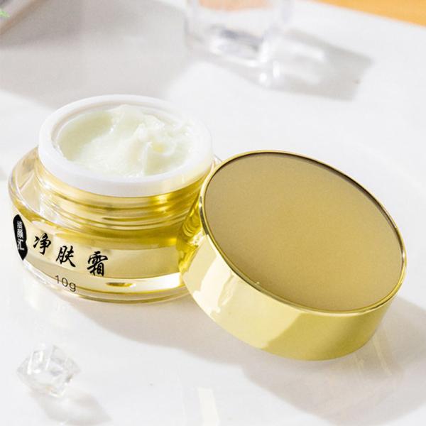 o tratamento final da acne do creme do ponto 30g ilumina e repara o creme de cara