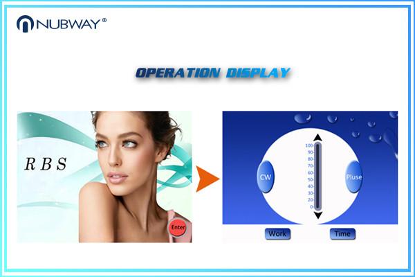 Two Different Needles 0.03mm 0.01mm  vein Spider Veins Skin Tags Removal Machine