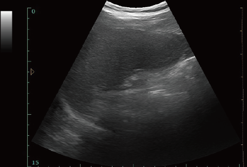Блок развертки ультразвука ноутбука ультразвука СИД 12 дюймов диагностический медицинский с одним зондом подключает программное обеспечение ветеринара доступное