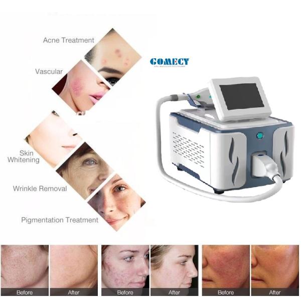 IPL HR SHR Skin Rejuvenation Beauty Machine For Salon