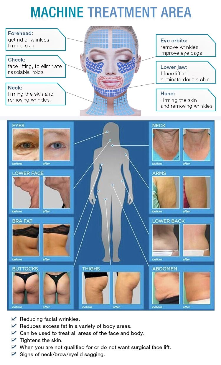 Portable 2-In-1 RF Ultrasonic Machine For Face Lifting & Eye Firming