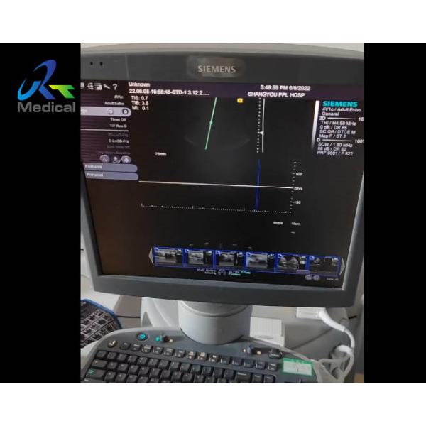 Siemens S2000 No Spectrum When Using Cw Function medical solutions