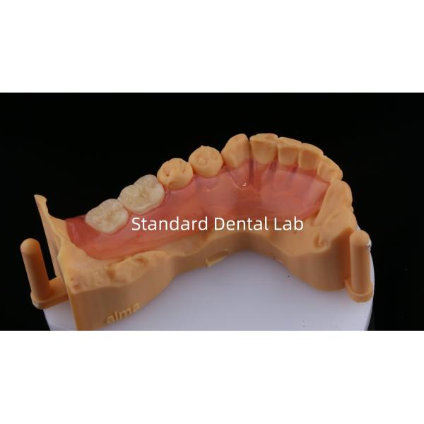 Ace Teeth Розовый/темный TCS Valplast Гибкие частичные зубные протезы для высокой эстетики