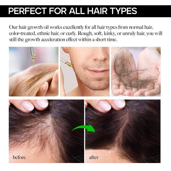 Частное масло роста волос Labe с кофеином, биотином для сильного, толстый, более длинным