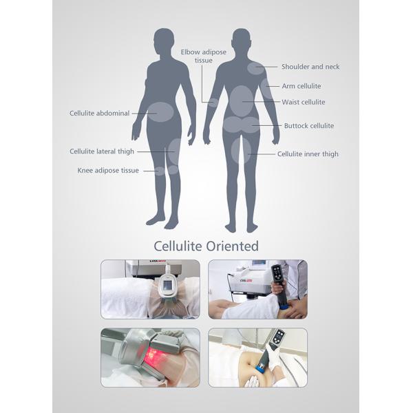 Тип внекорпусная машина 4 ручек терапией ударной волны, машина Cryolipolysis для домашней пользы