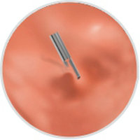 Продукты устранимого Эндоскопик зажима Хемо медицинские потребляемые 2 лет гарантии