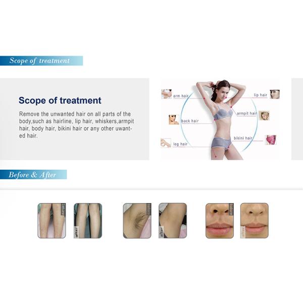2018 pain free Ice cooling permanent diode Soprano hair removal laser