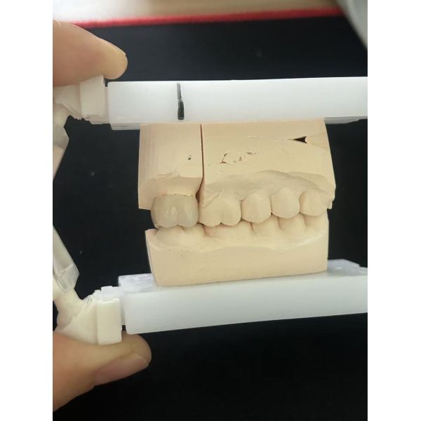 High Strength 1200 MPa Zirconia Crown with Excellent Biocompatibility and Long-lasting Durability for Dental Restoration