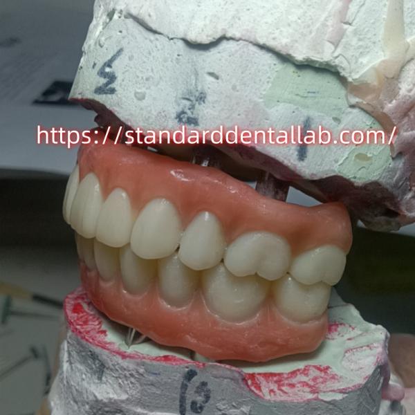 Зубной имплантат Временная корона ПММА мост с розовым фарфором